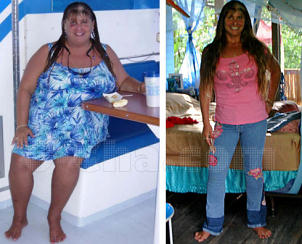 before and after pics of Sierra losing 170 pounds